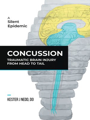 cover image of Concussion